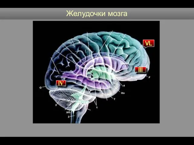 Желудочки мозга VL III IV