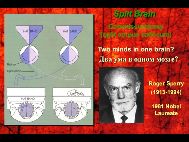 Roger Sperry (1913-1994) 1981 Nobel Laureate Split Brain Commissuratomy (split corpus