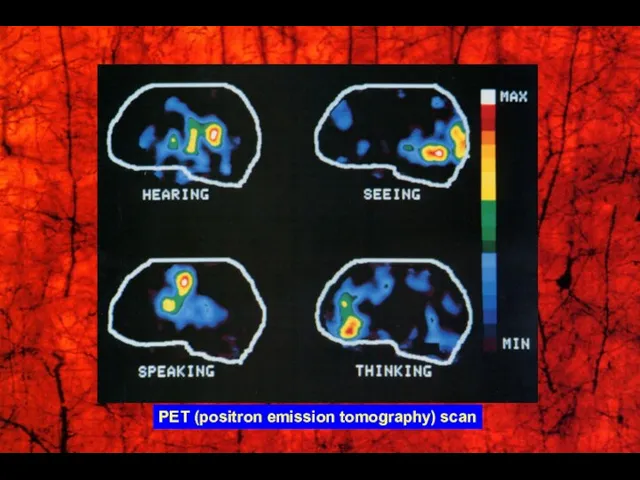 PET (positron emission tomography) scan