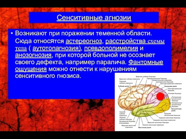 Сенситивные агнозии Возникают при поражении теменной области. Сюда относятся астереогноз, расстройства