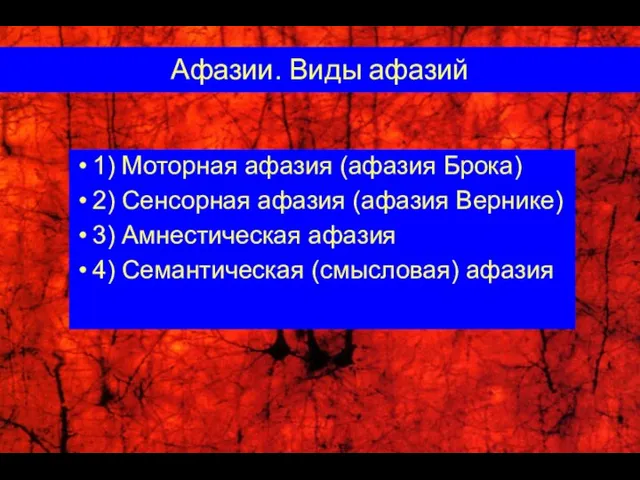 Афазии. Виды афазий 1) Моторная афазия (афазия Брока) 2) Сенсорная афазия