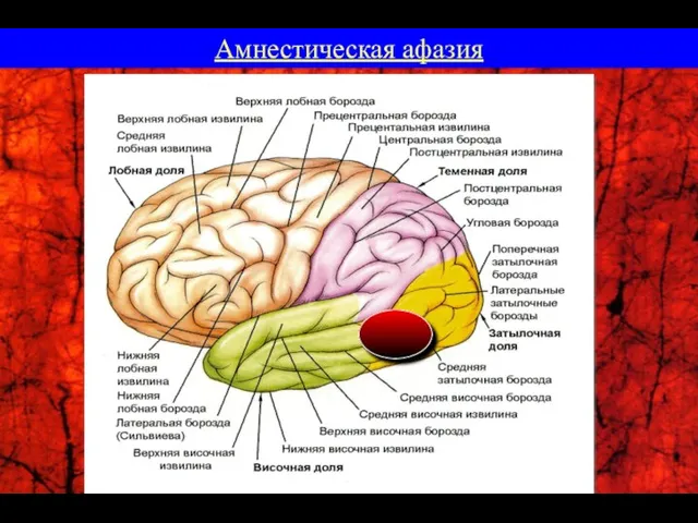 Амнестическая афазия