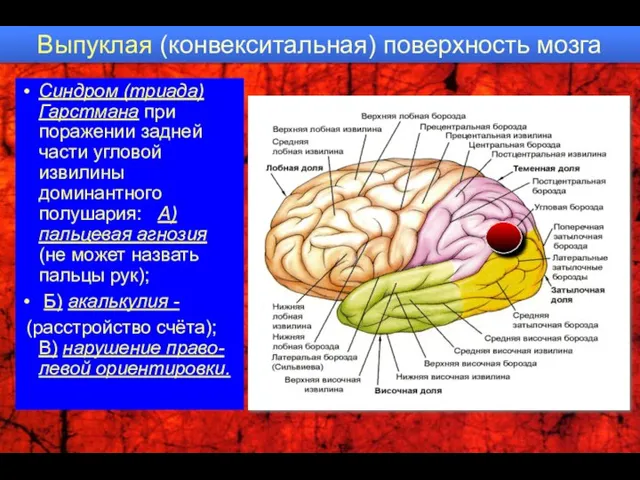 Выпуклая (конвекситальная) поверхность мозга Синдром (триада) Гарстмана при поражении задней части