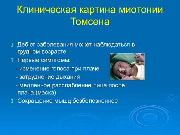 Клиническая картина миотонии Томсена Дебют заболевания может наблюдаться в грудном возрасте