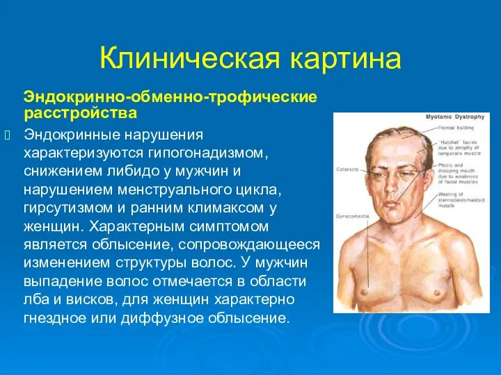 Клиническая картина Эндокринно-обменно-трофические расстройства Эндокринные нарушения характеризуются гипогонадизмом, снижением либидо у