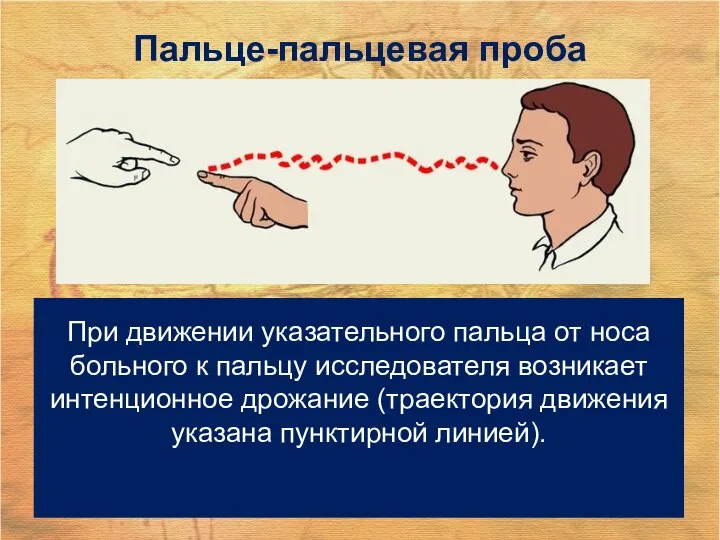 При движении указательного пальца от носа больного к пальцу исследователя возникает