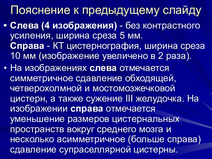 Пояснение к предыдущему слайду Слева (4 изображения) - без контрастного усиления,