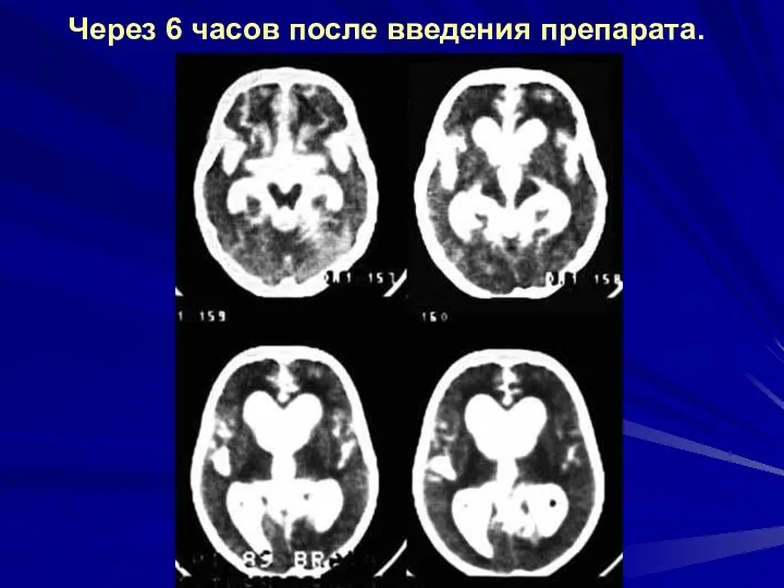 Через 6 часов после введения препарата.