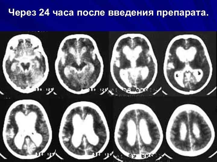 Через 24 часа после введения препарата.