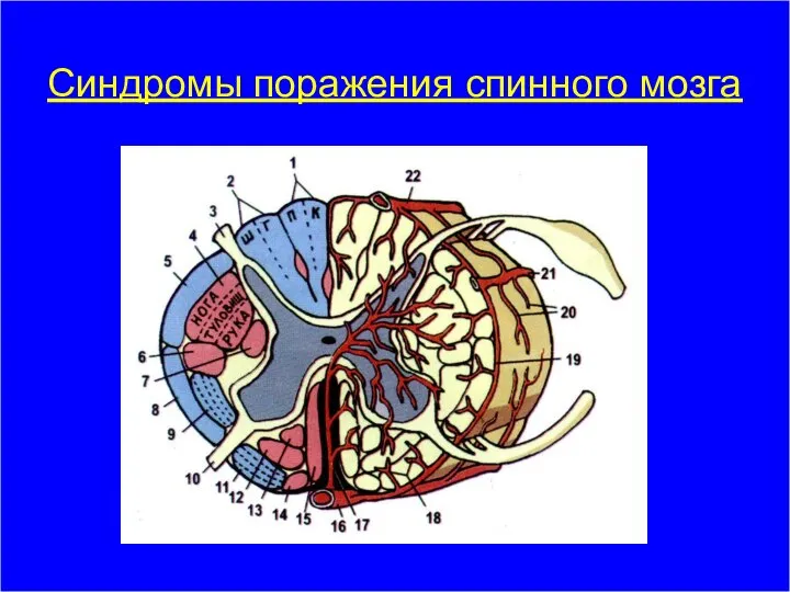 Синдромы поражения спинного мозга