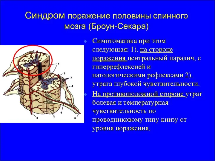 Синдром поражение половины спинного мозга (Броун-Секара) Симптоматика при этом следующая: 1).