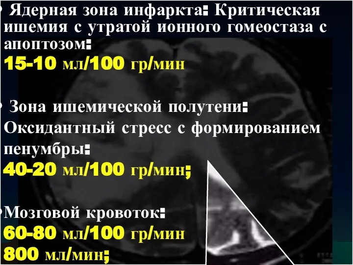 Ядерная зона инфаркта: Критическая ишемия с утратой ионного гомеостаза с апоптозом: