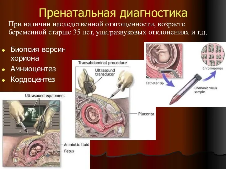 Пренатальная диагностика Биопсия ворсин хориона Амниоцентез Кордоцентез При наличии наследственной отягощенности,