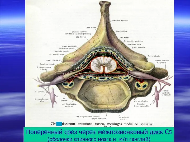Поперечный срез через межпозвонковый диск С5 (оболочки спинного мозга и м/п ганглий)