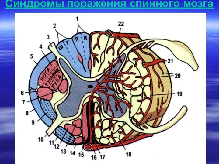 Синдромы поражения спинного мозга