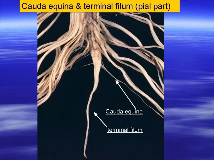 Cauda equina & terminal filum (pial part) terminal filum Cauda equina