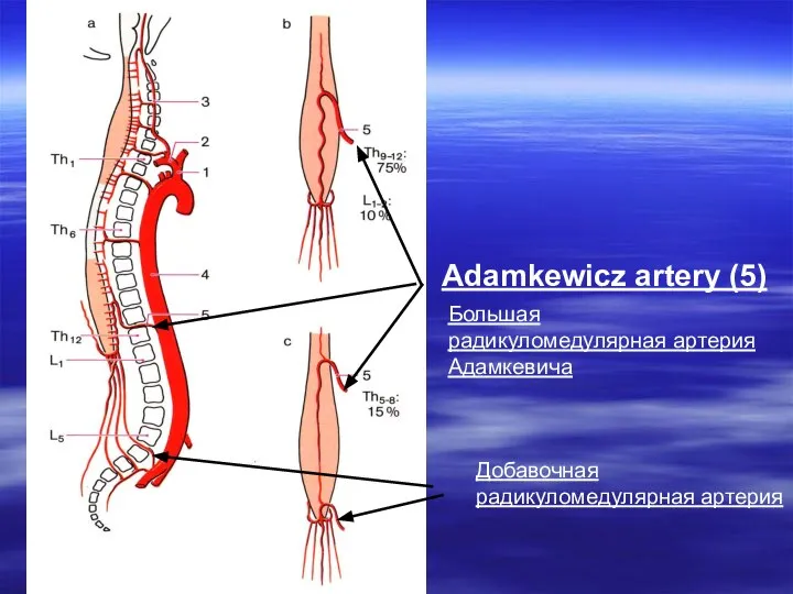 Adamkеwicz artery (5) Большая радикуломедулярная артерия Адамкевича Добавочная радикуломедулярная артерия