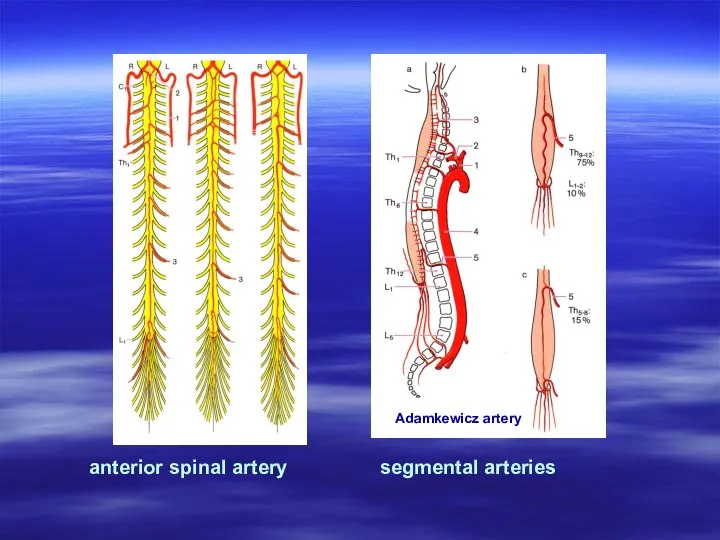 anterior spinal artery segmental arteries Adamkеwicz artery