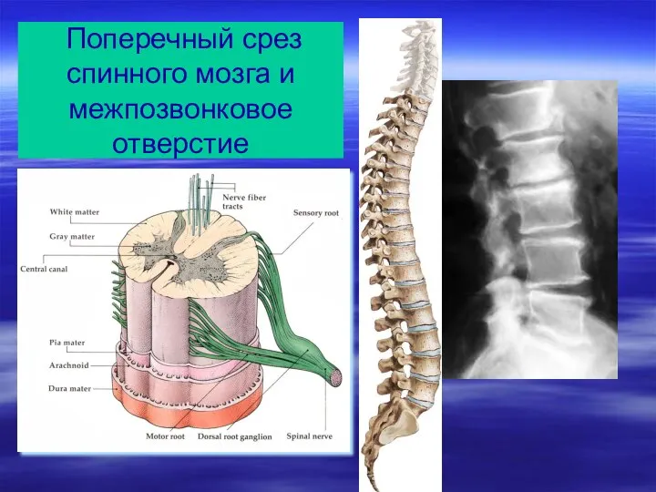 Поперечный срез спинного мозга и межпозвонковое отверстие