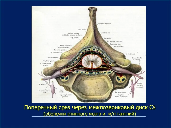Поперечный срез через межпозвонковый диск С5 (оболочки спинного мозга и м/п ганглий)