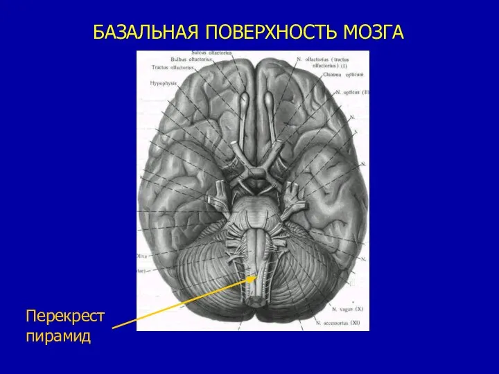 БАЗАЛЬНАЯ ПОВЕРХНОСТЬ МОЗГА Перекрест пирамид