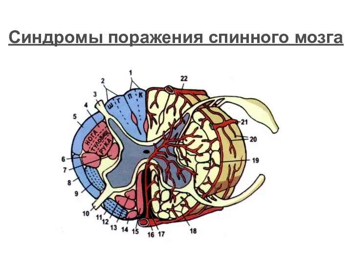 Синдромы поражения спинного мозга