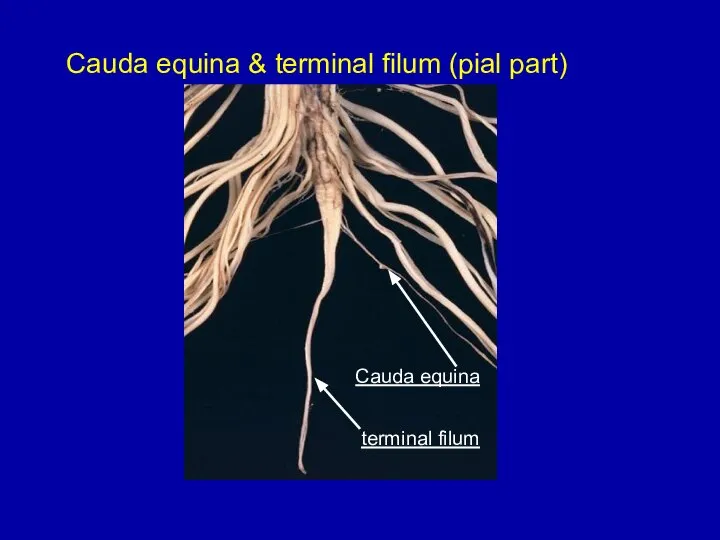 Cauda equina & terminal filum (pial part) terminal filum Cauda equina