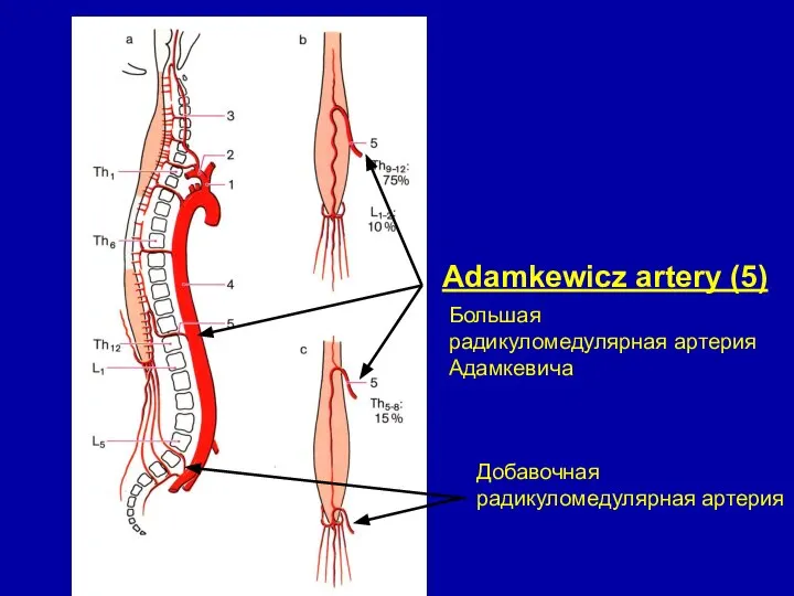 Adamkеwicz artery (5) Большая радикуломедулярная артерия Адамкевича Добавочная радикуломедулярная артерия