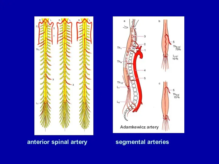 anterior spinal artery segmental arteries Adamkеwicz artery