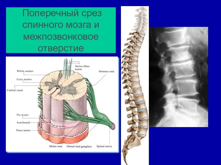 Поперечный срез спинного мозга и межпозвонковое отверстие