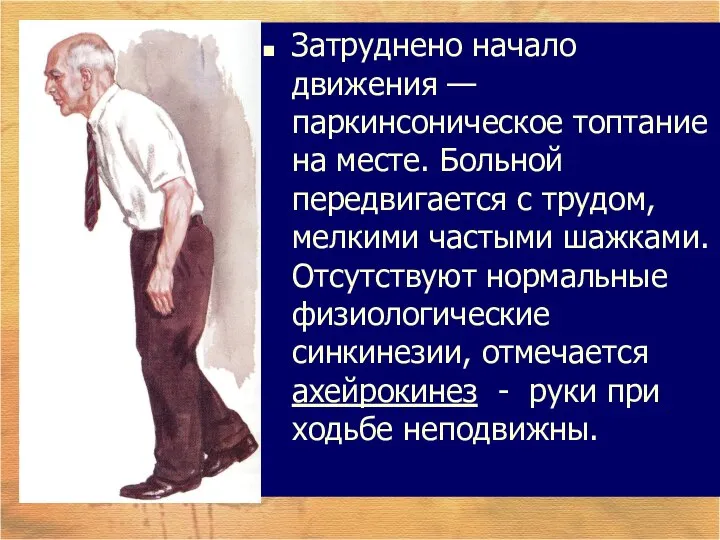 Затруднено начало движения — паркинсоническое топтание на месте. Больной передвигается с