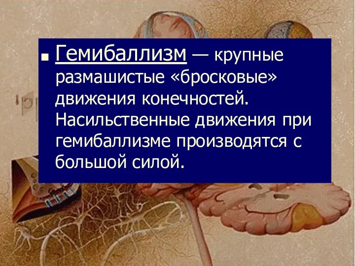 Гемибаллизм — крупные размашистые «бросковые» движения конечностей. Насильственные движения при гемибаллизме производятся с большой силой.