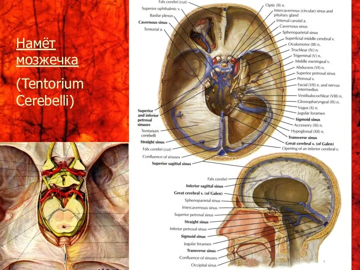 Намёт мозжечка (Tentorium Cerebelli)