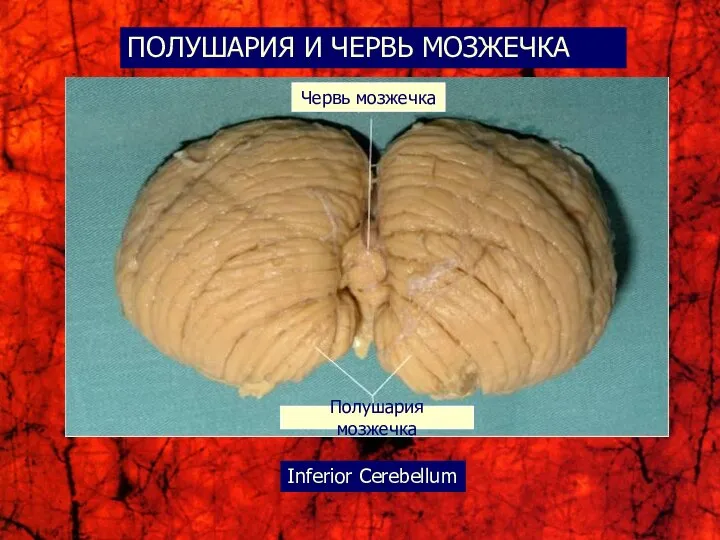 ПОЛУШАРИЯ И ЧЕРВЬ МОЗЖЕЧКА Червь мозжечка Полушария мозжечка Inferior Cerebellum