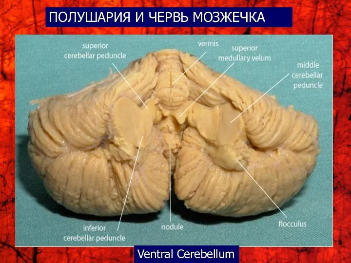 Ventral Cerebellum ПОЛУШАРИЯ И ЧЕРВЬ МОЗЖЕЧКА