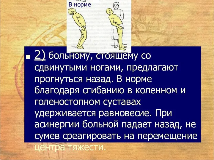 2) больному, стоящему со сдвинутыми ногами, предлагают прогнуться назад. В норме