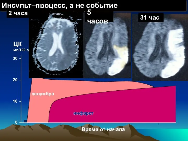 0 10 20 30 ЦК мл/100 г/мин Время от начала пенумбра