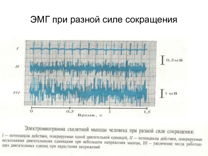 ЭМГ при разной силе сокращения