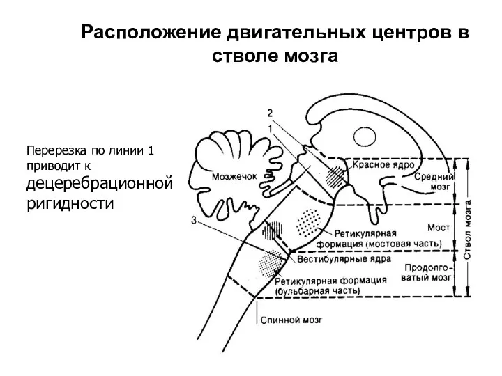 Расположение двигательных центров в стволе мозга Перерезка по линии 1 приводит к децеребрационной ригидности