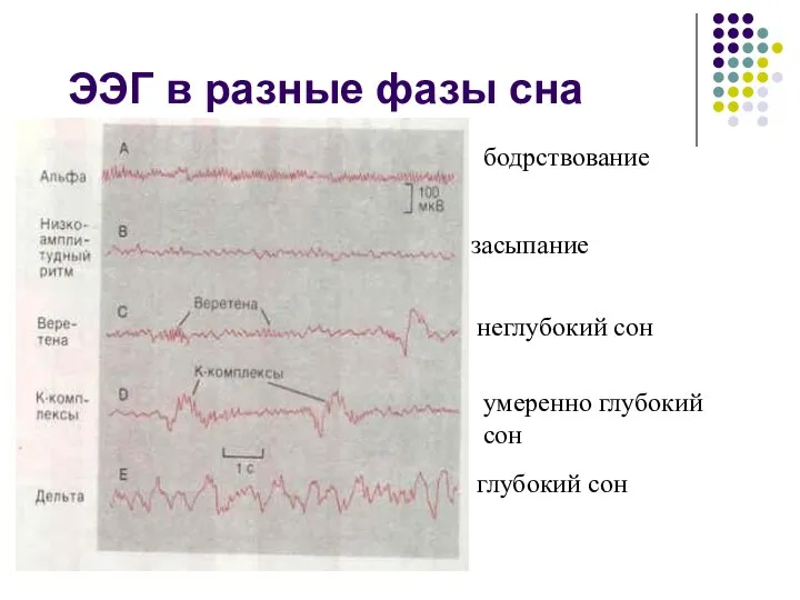 ЭЭГ в разные фазы сна бодрствование засыпание неглубокий сон умеренно глубокий сон глубокий сон