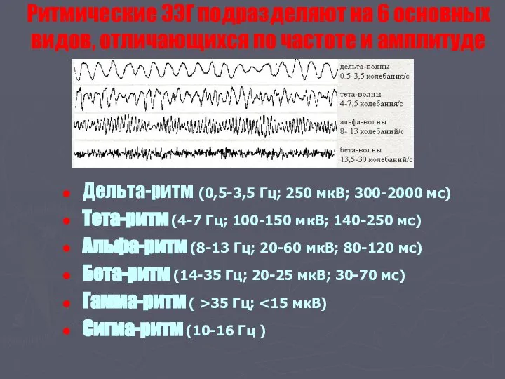 Ритмические ЭЭГ подразделяют на 6 основных видов, отличающихся по частоте и