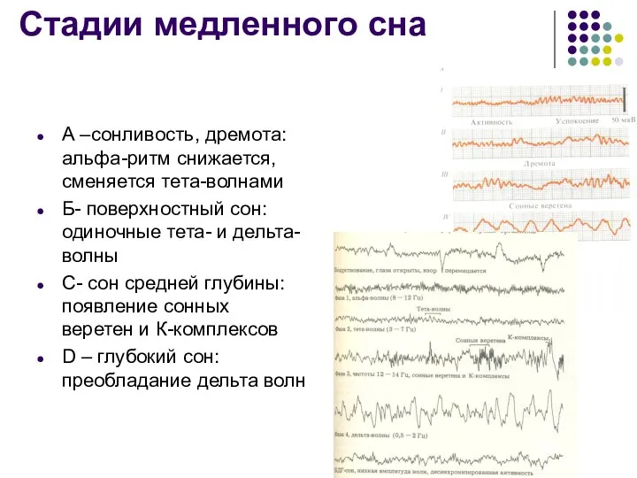 Стадии медленного сна А –сонливость, дремота: альфа-ритм снижается, сменяется тета-волнами Б-