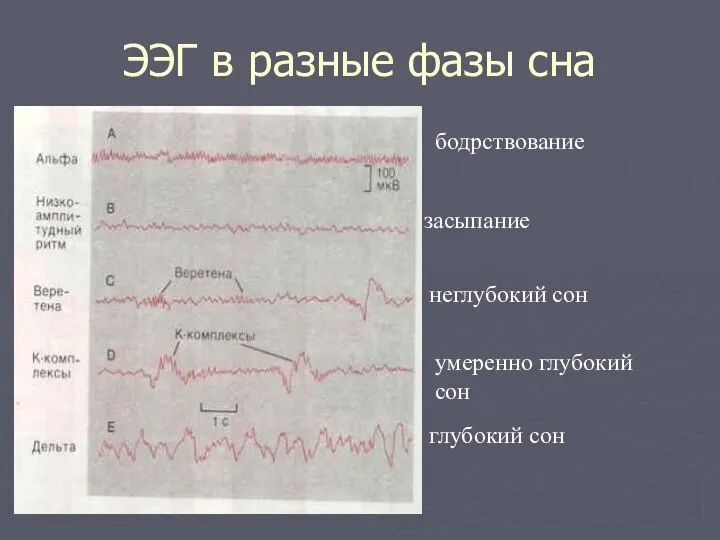 ЭЭГ в разные фазы сна бодрствование засыпание неглубокий сон умеренно глубокий сон глубокий сон