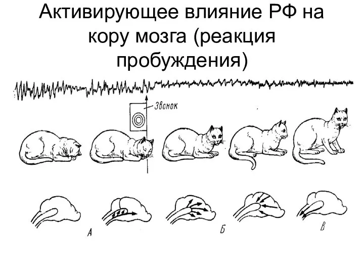 Активирующее влияние РФ на кору мозга (реакция пробуждения)