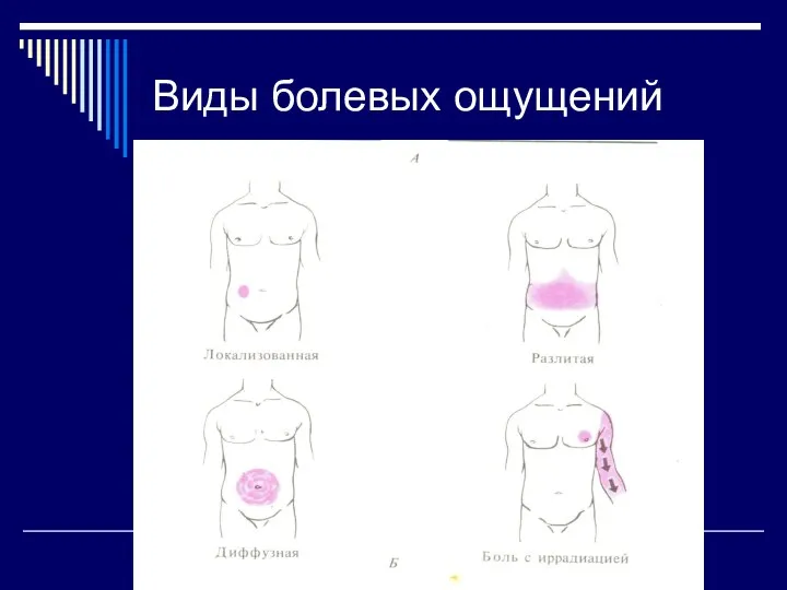 Виды болевых ощущений