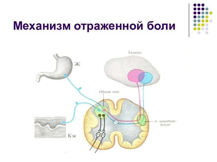 Механизм отраженной боли