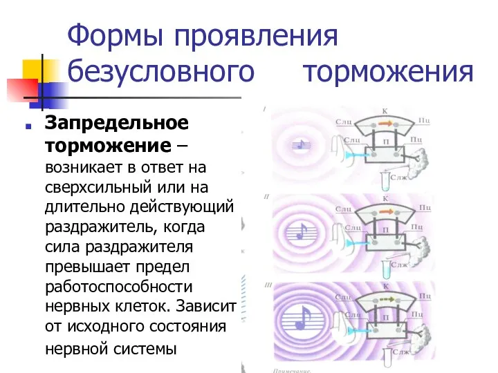 Формы проявления безусловного торможения Запредельное торможение – возникает в ответ на