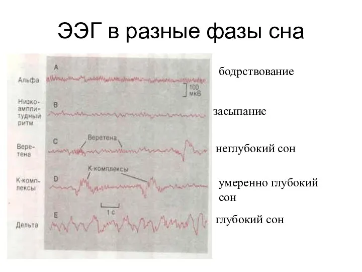 ЭЭГ в разные фазы сна бодрствование засыпание неглубокий сон умеренно глубокий сон глубокий сон