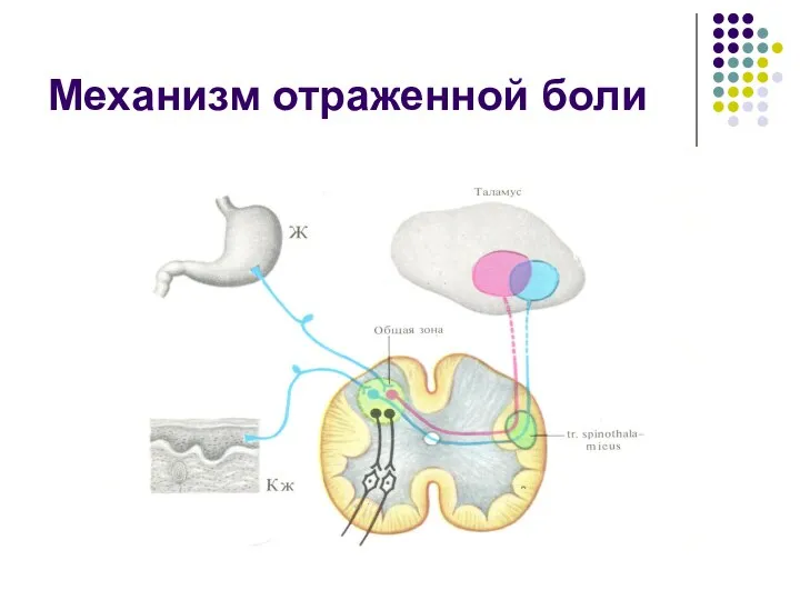 Механизм отраженной боли