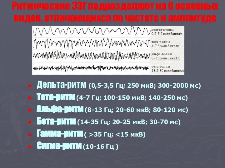 Ритмические ЭЭГ подразделяют на 6 основных видов, отличающихся по частоте и